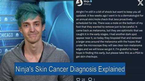 what cancer does ninja have